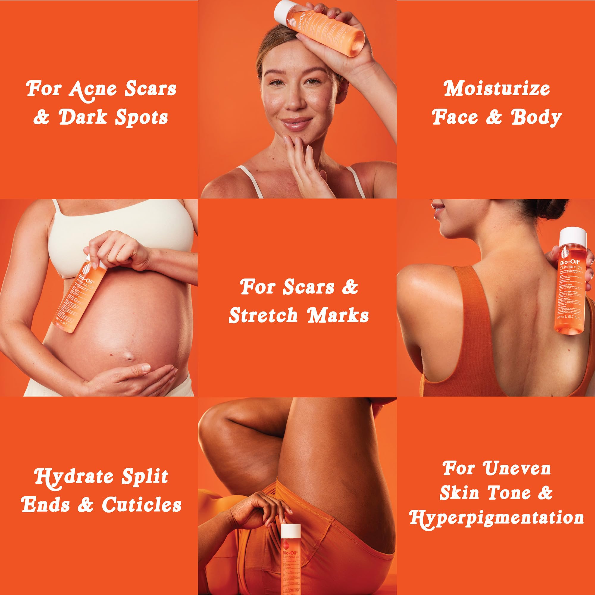 Bio-Oil Skincare Body Oil Serum for Scars and Stretch Marks, Face and Body Moisturizer with Vitamin E & A for Sensitive Dry Skin, Dermatologist Recommended, Non-Comedogenic, 4.2 Oz